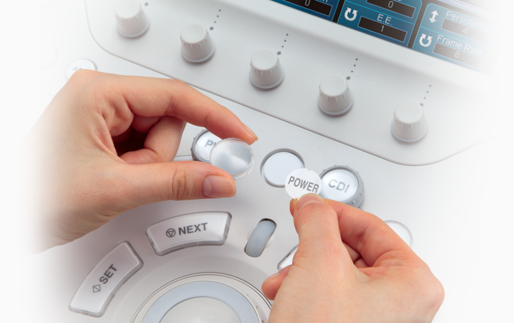 Ultrasound Aplio Overview Istyle 1024x643