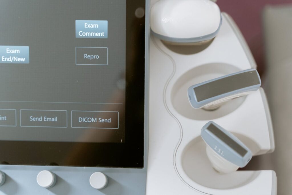 Close-up image of ultrasound equipment showing the monitor and probe holders.