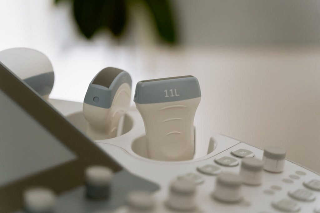 A detailed view of medical ultrasound equipment in a healthcare facility.